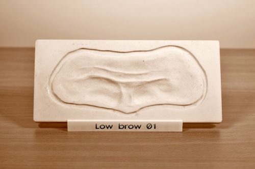 Prosthetic mould Low brow 01